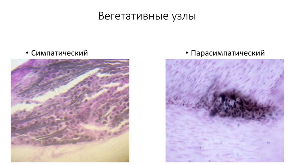 Вегетативные узлы