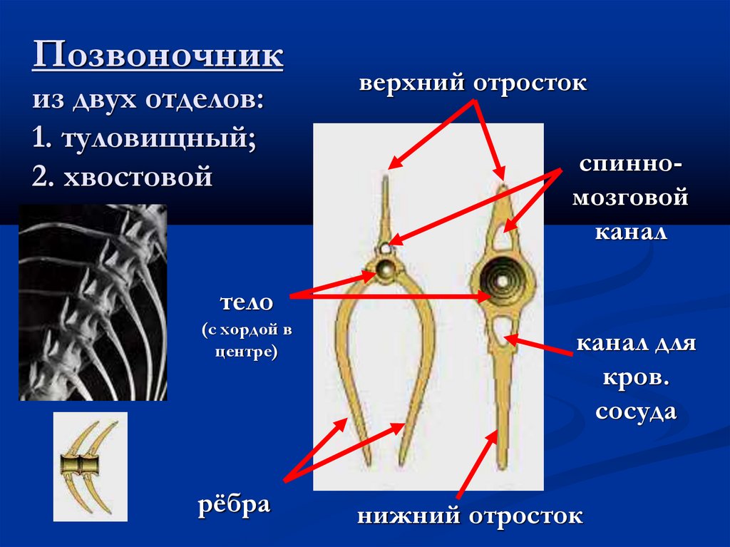 Позвоночник из двух отделов: 1. туловищный; 2. хвостовой