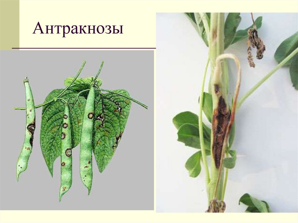 Антракнозы