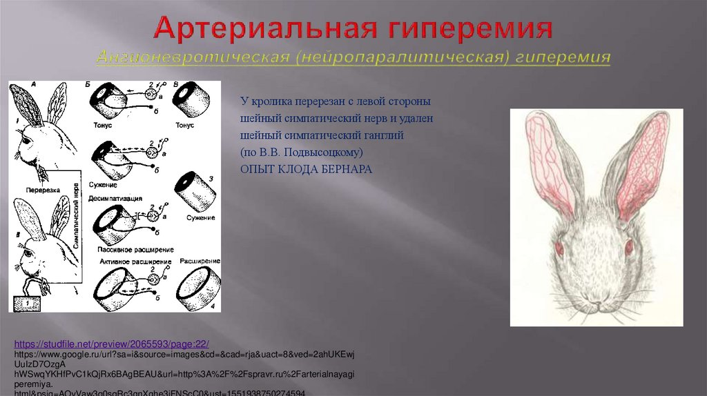Артериальная гиперемия Ангионевротическая (нейропаралитическая) гиперемия