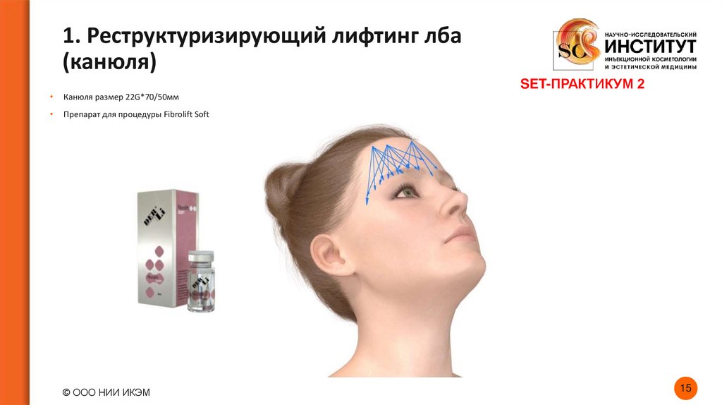 1. Реструктуризирующий лифтинг лба (канюля)