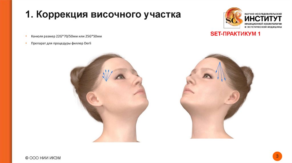 1. Коррекция височного участка