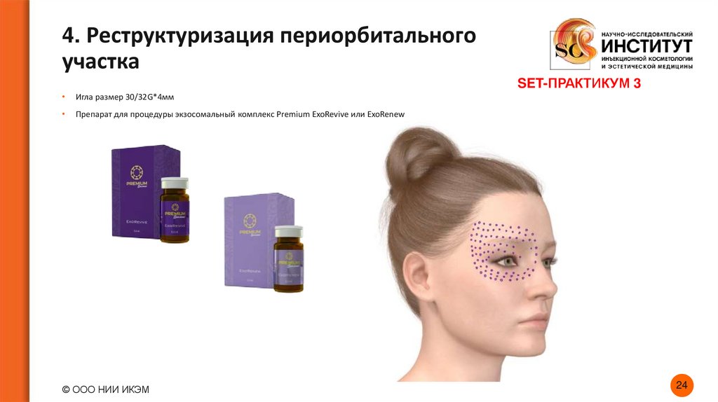 4. Реструктуризация периорбитального участка