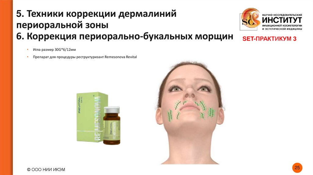 5. Техники коррекции дермалиний периоральной зоны 6. Коррекция периорально-букальных морщин