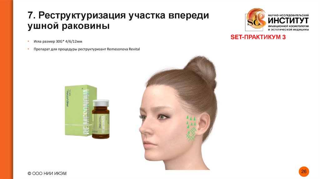 7. Реструктуризация участка впереди ушной раковины