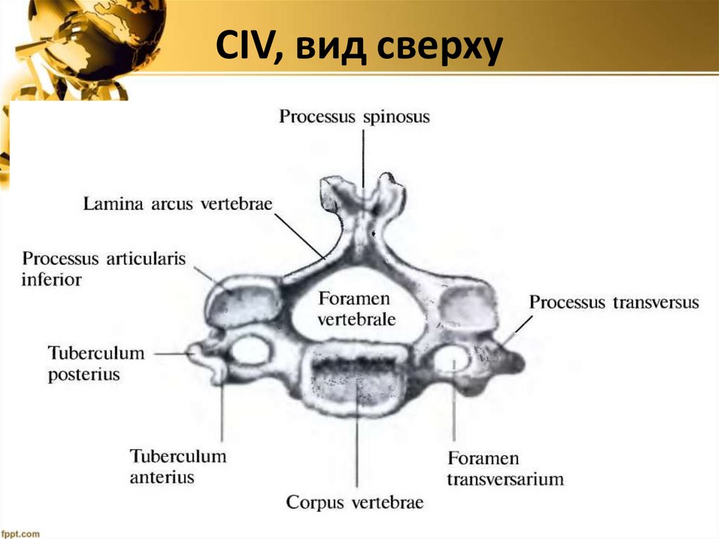 СIV, вид сверху