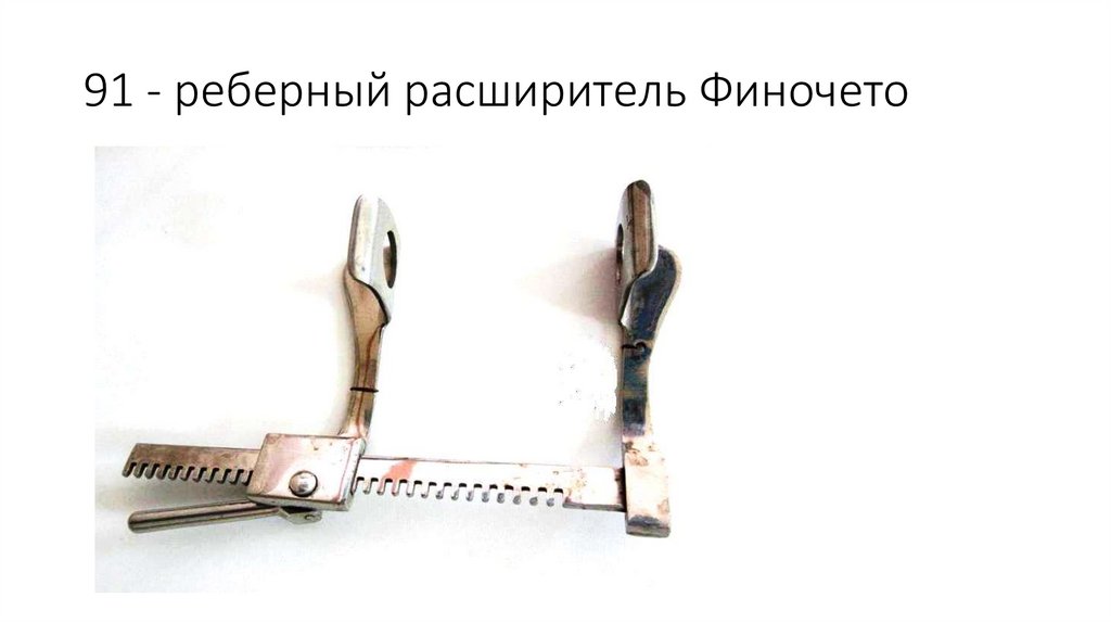 91 - реберный расширитель Финочето