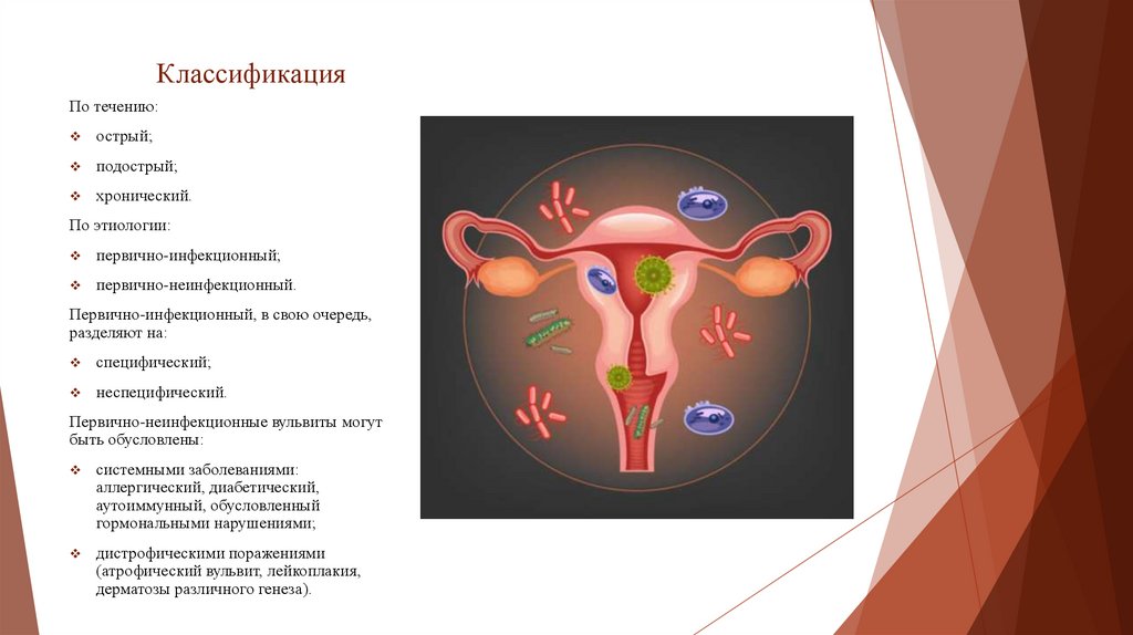 Классификация