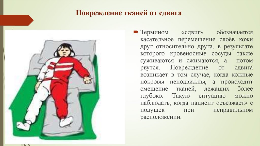 Повреждение тканей от сдвига