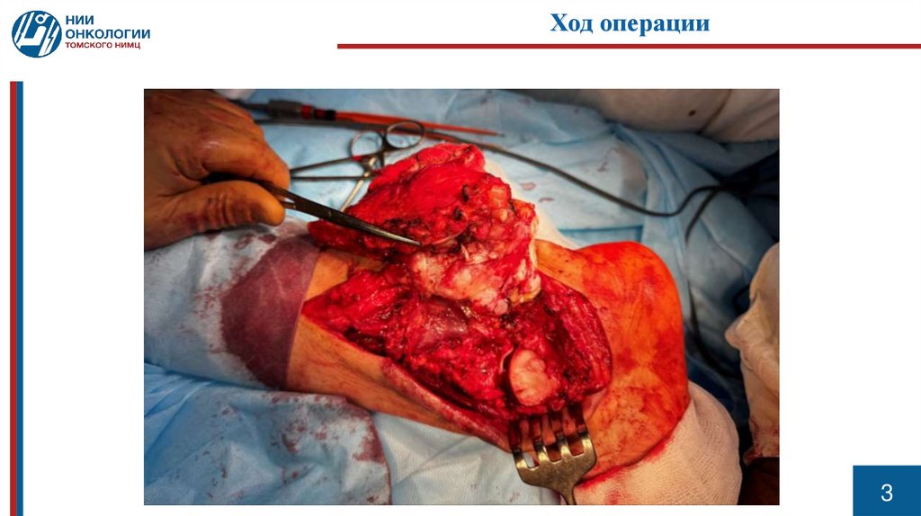 Клинико-рентгенологическая картина