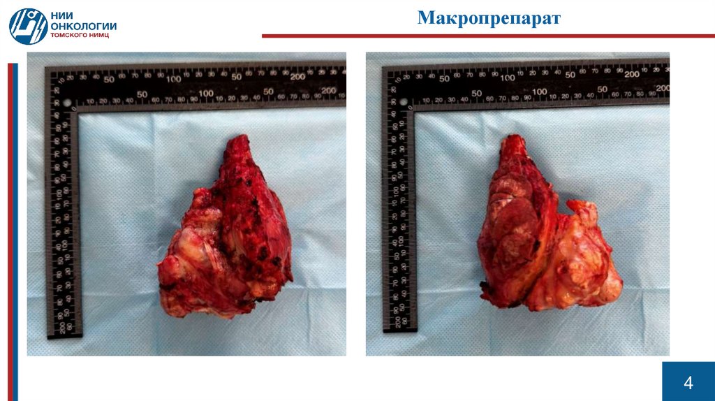 Макропрепарат
