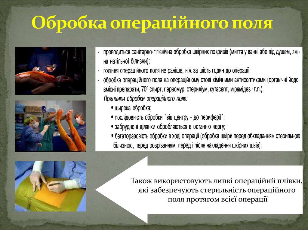 Обробка операційного поля