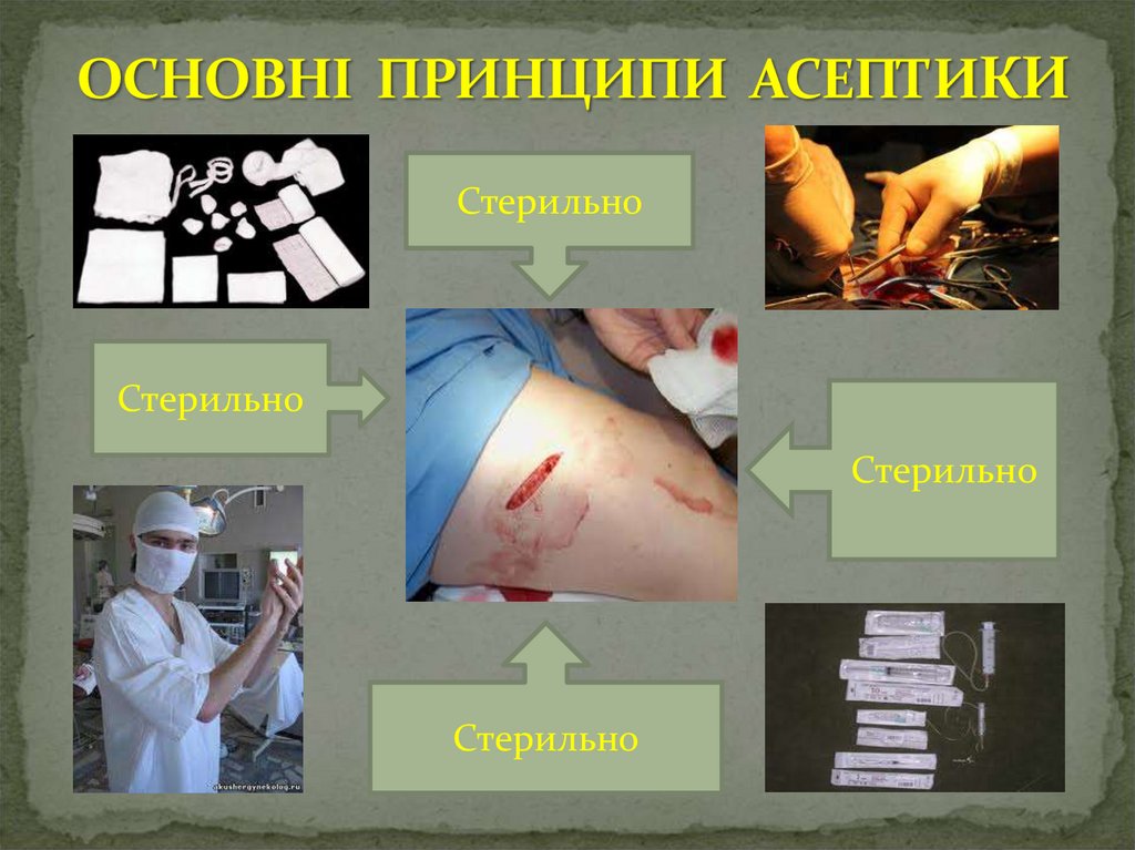 ОСНОВНІ ПРИНЦИПИ АСЕПТИКИ