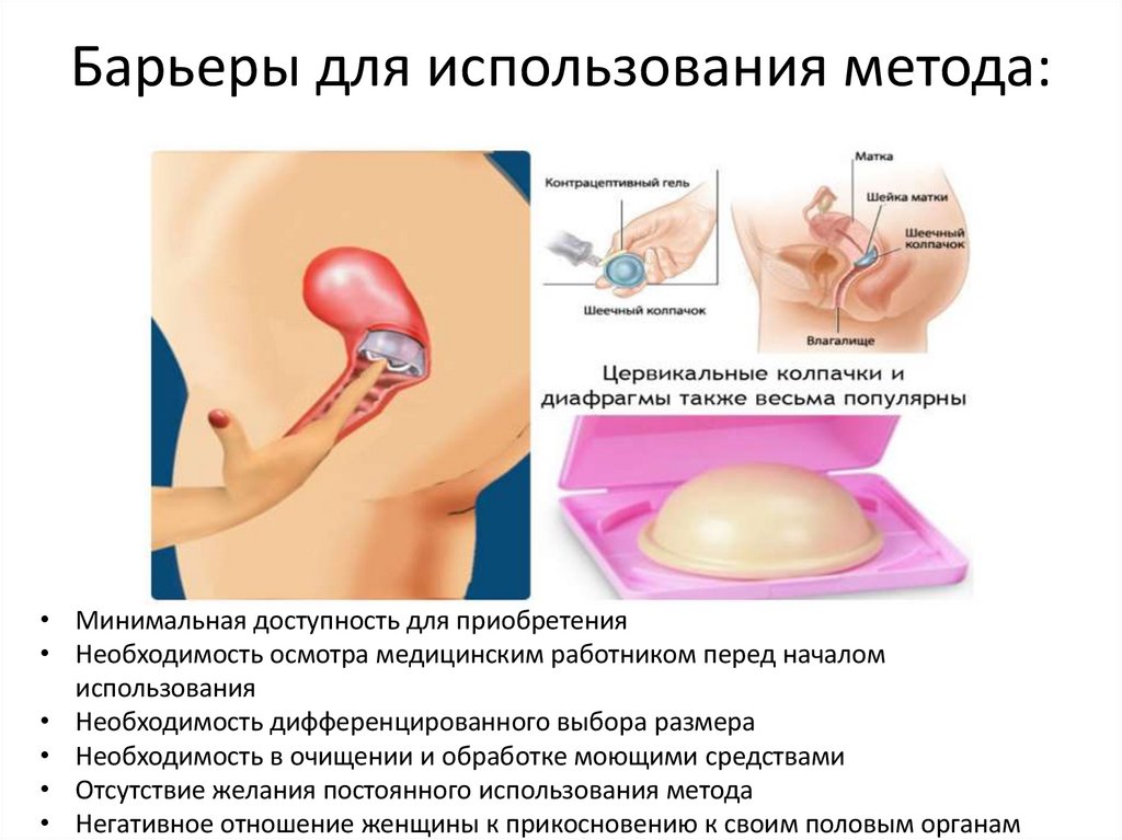 Барьеры для использования метода: