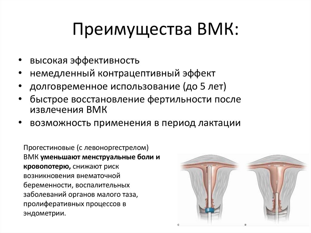 Преимущества ВМК: