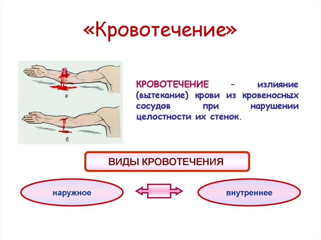 «Кровотечение»