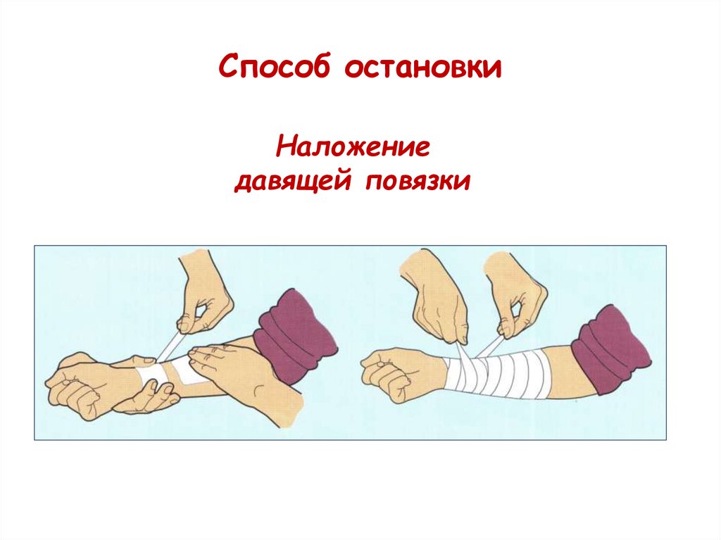 Способ остановки