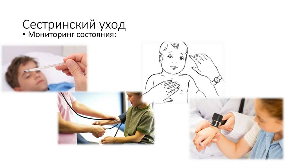 Сестринский уход