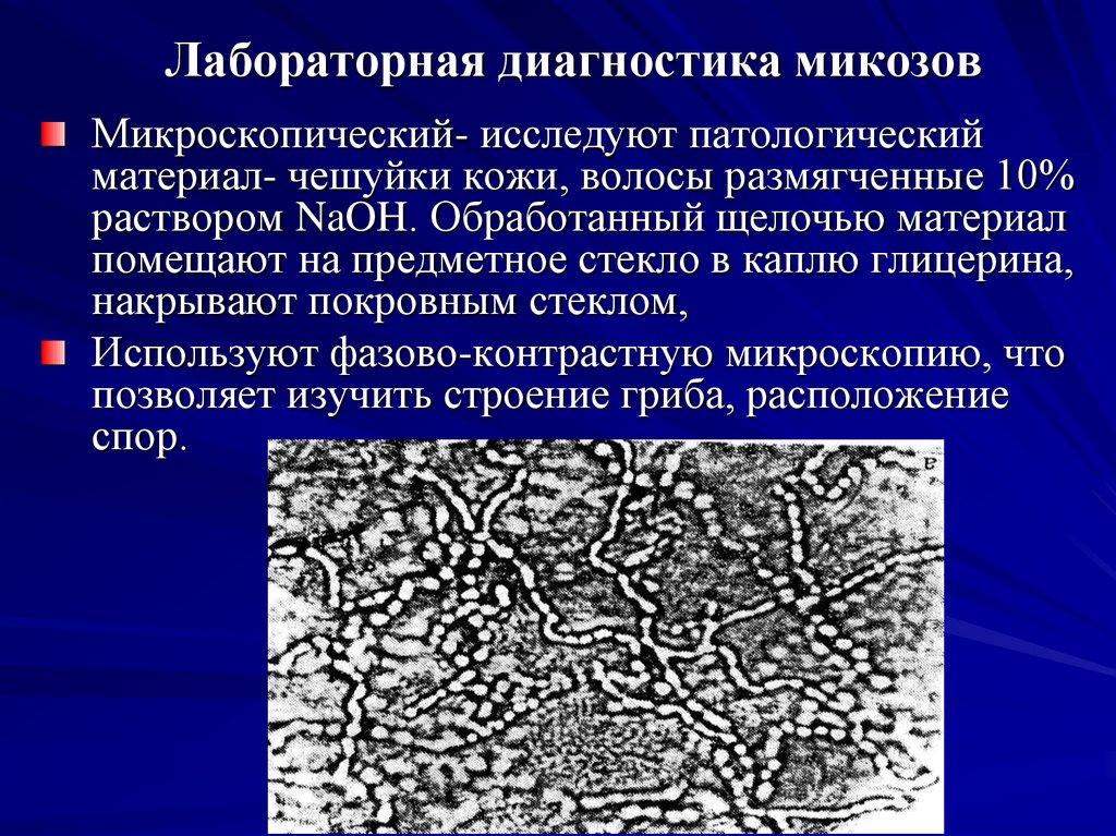 Лабораторная диагностика микозов