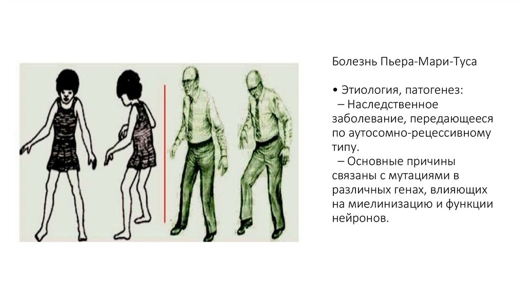 Болезнь Пьера-Мари-Туса • Этиология, патогенез: – Наследственное заболевание, передающееся по аутосомно-рецессивному типу. –