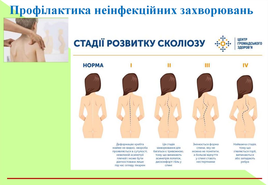 Профілактика неінфекційних захворювань