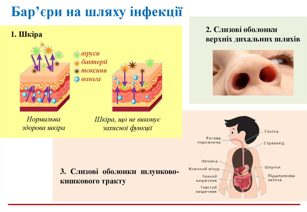 Бар’єри на шляху інфекції