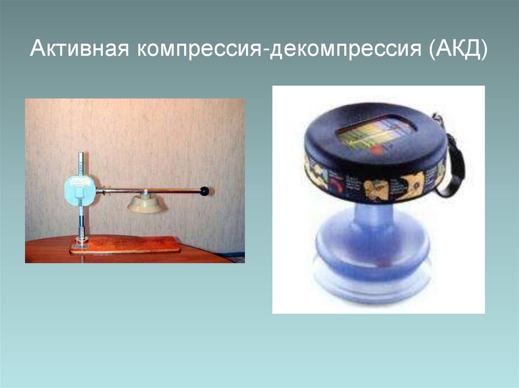 Активная компрессия-декомпрессия (АКД)