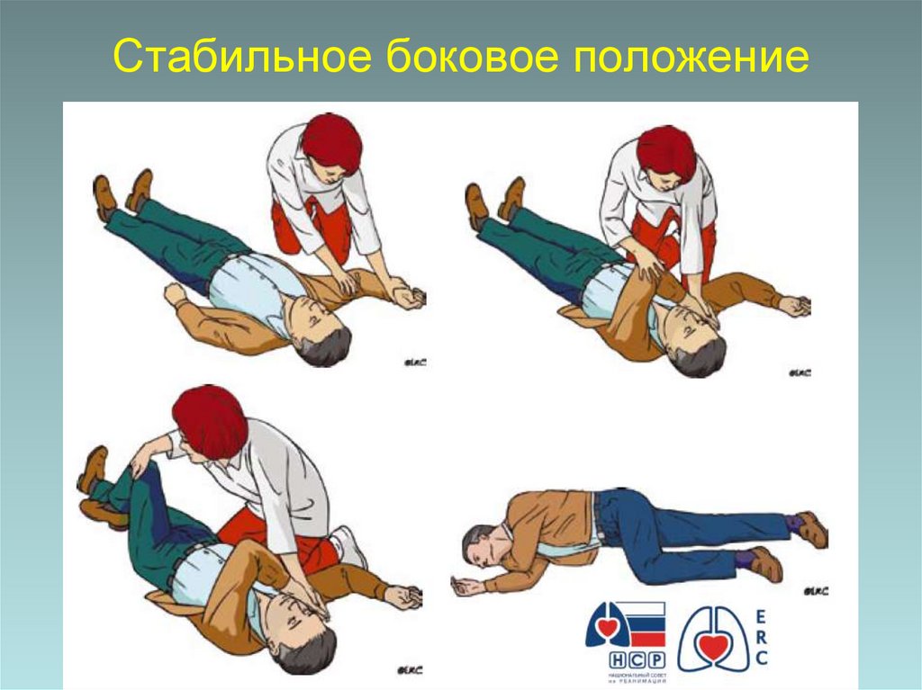 Стабильное боковое положение