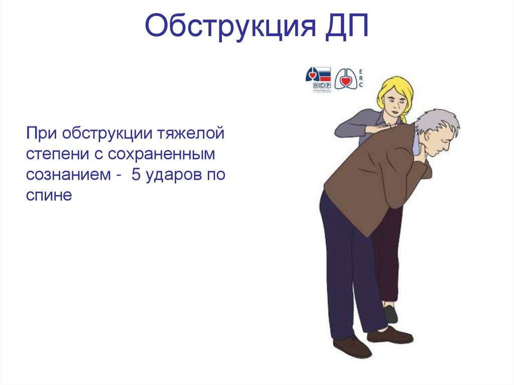 Обструкция ДП