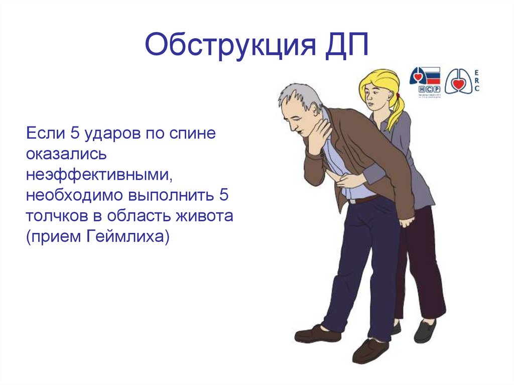 Обструкция ДП