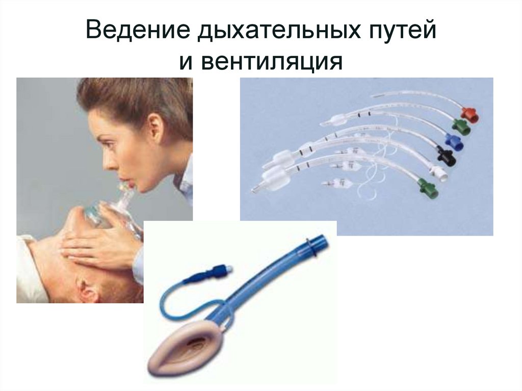 Ведение дыхательных путей и вентиляция