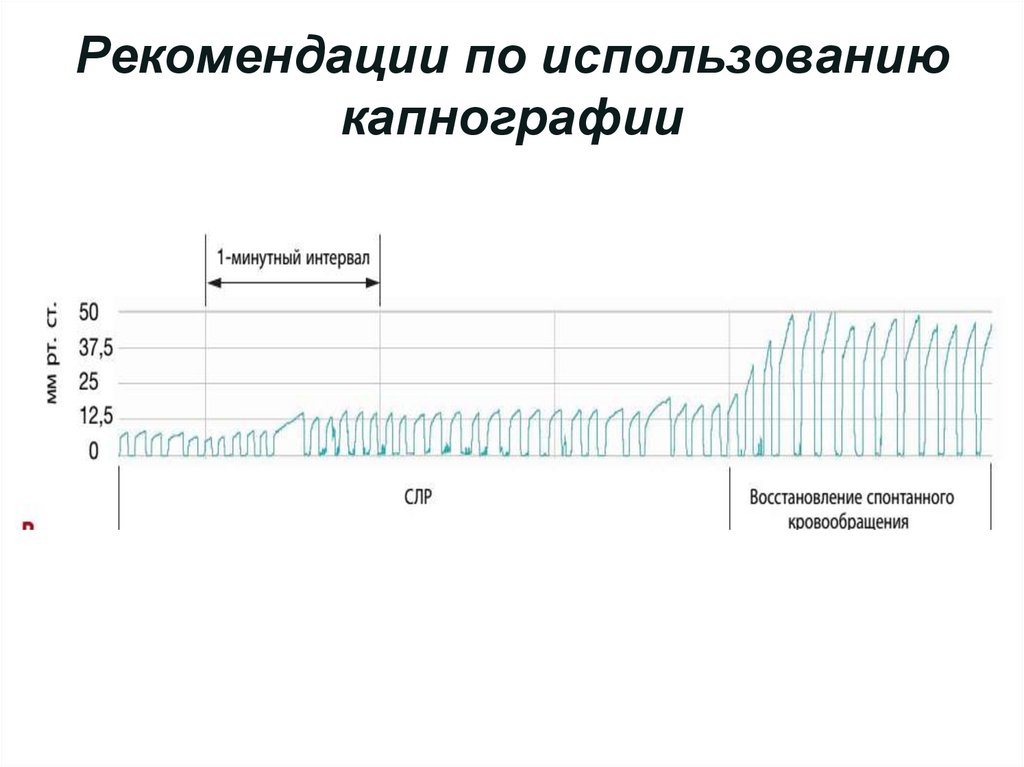 Рекомендации по использованию капнографии
