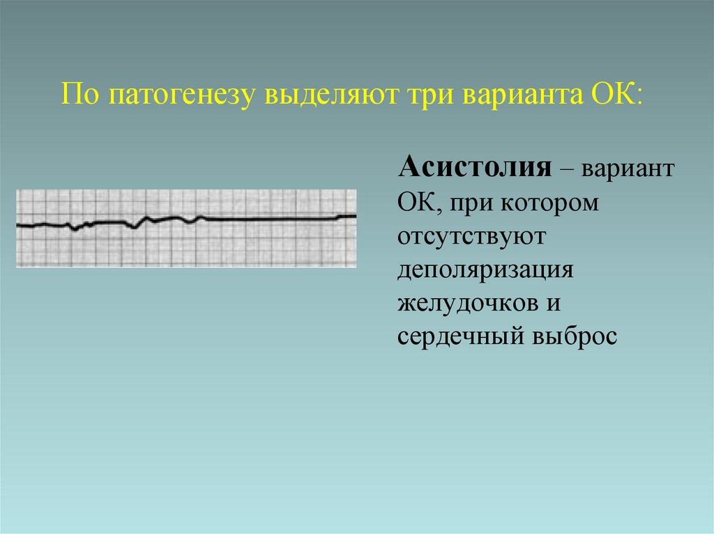 По патогенезу выделяют три варианта ОК: