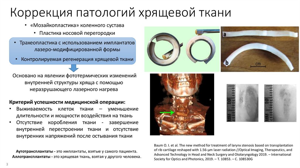 Коррекция патологий хрящевой ткани