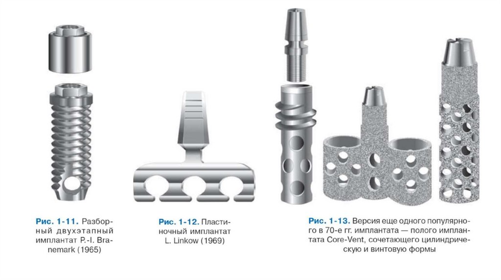 4-bosqich: Osteointegratsiya