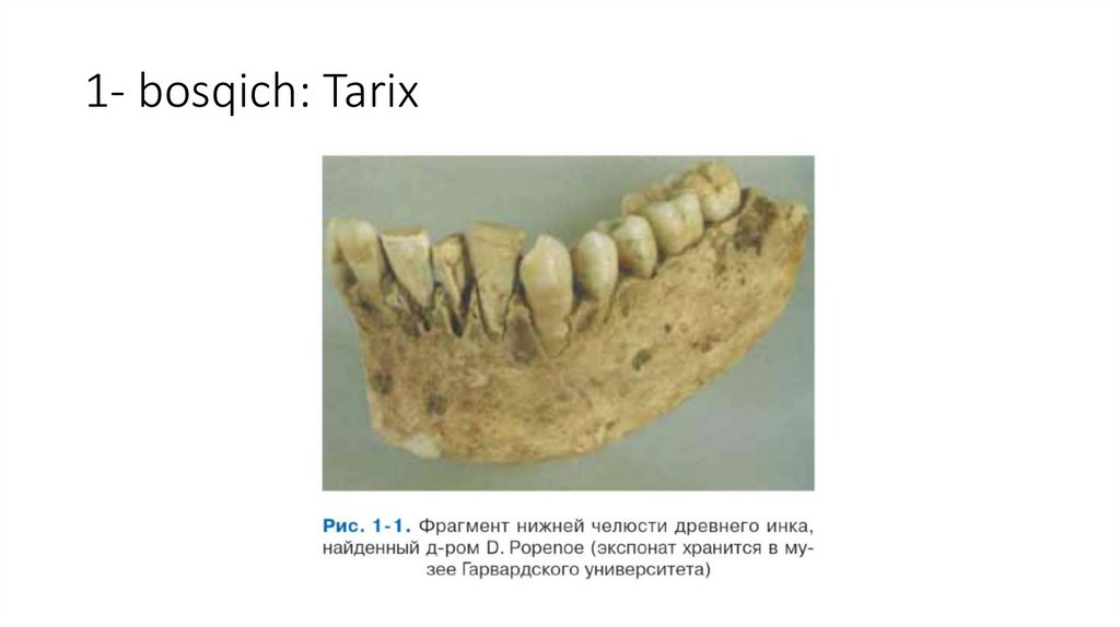 1- bosqich: Tarix