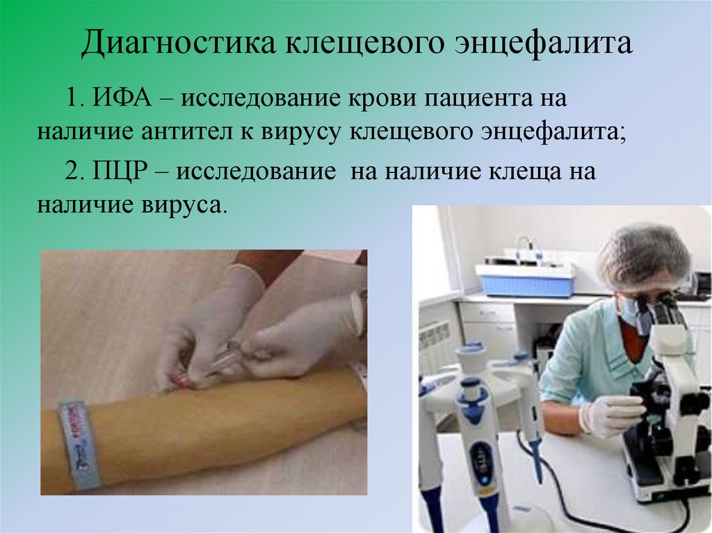 Диагностика клещевого энцефалита