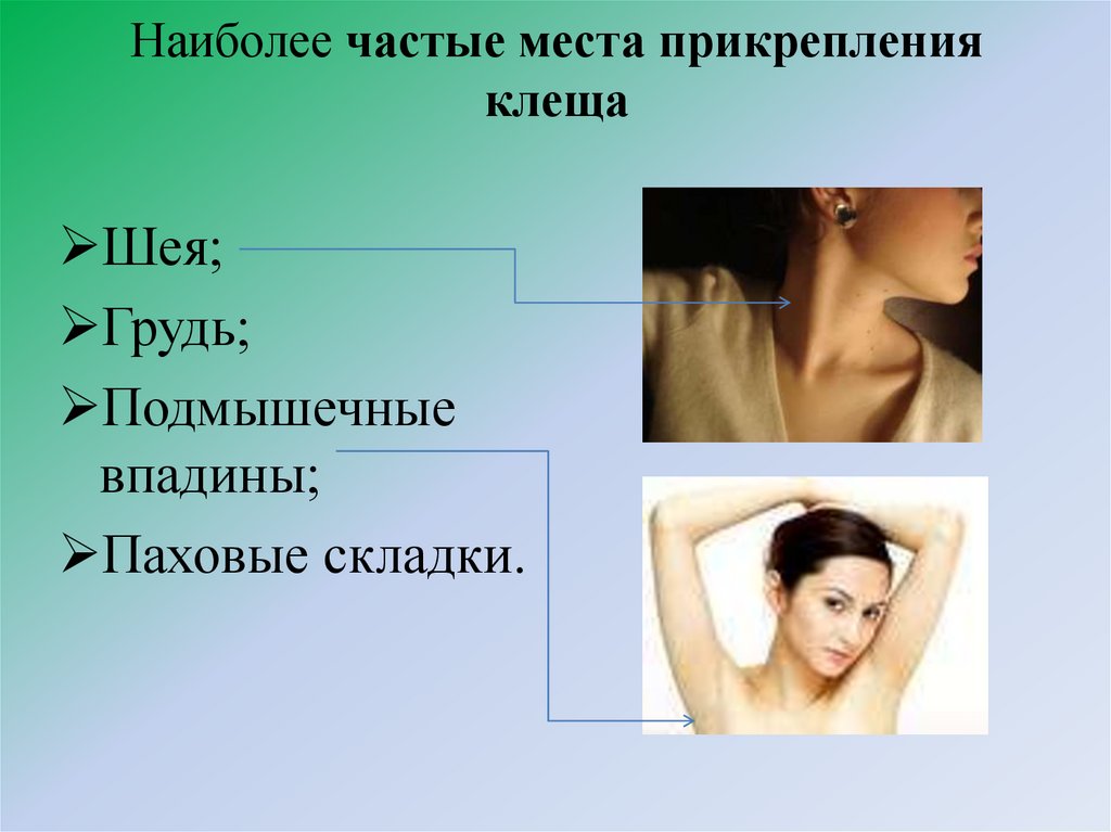 Наиболее частые места прикрепления клеща