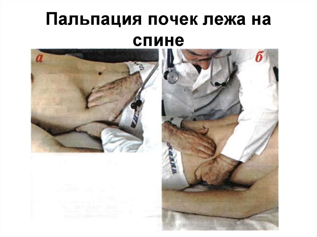 Пальпация почек лежа на спине
