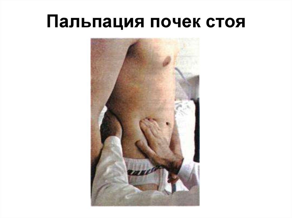 Пальпация почек стоя