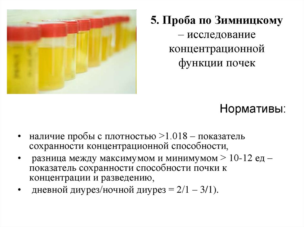 5. Проба по Зимницкому – исследование концентрационной функции почек