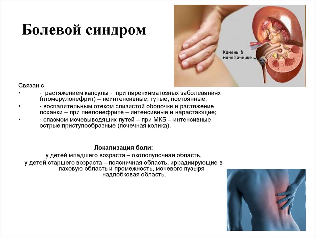 Болевой синдром