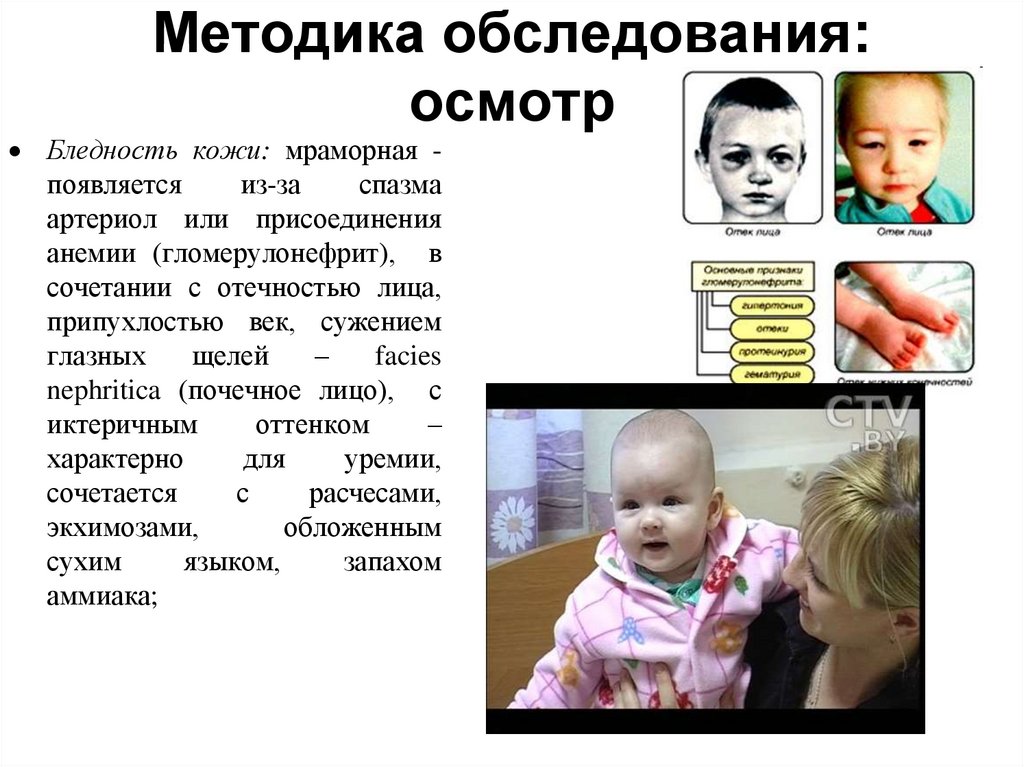 Методика обследования: осмотр