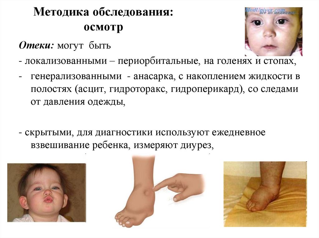 Методика обследования: осмотр