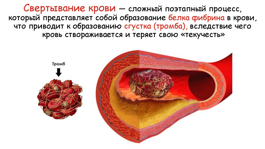 Свертывание крови — сложный поэтапный процесс, который представляет собой образование белка фибрина в крови, что приводит к