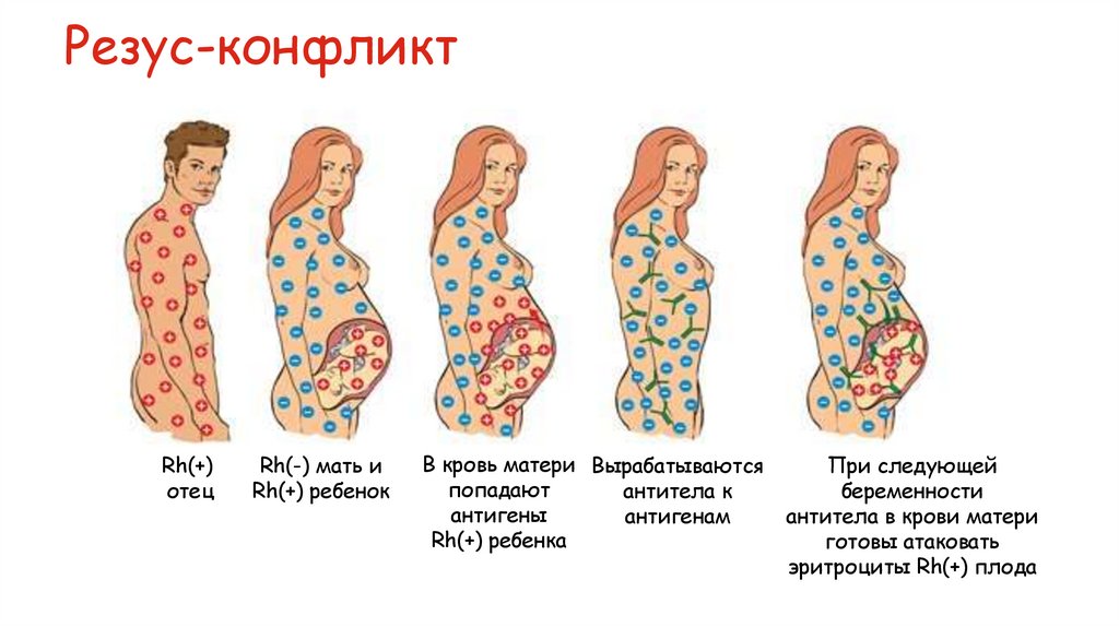 Резус-конфликт