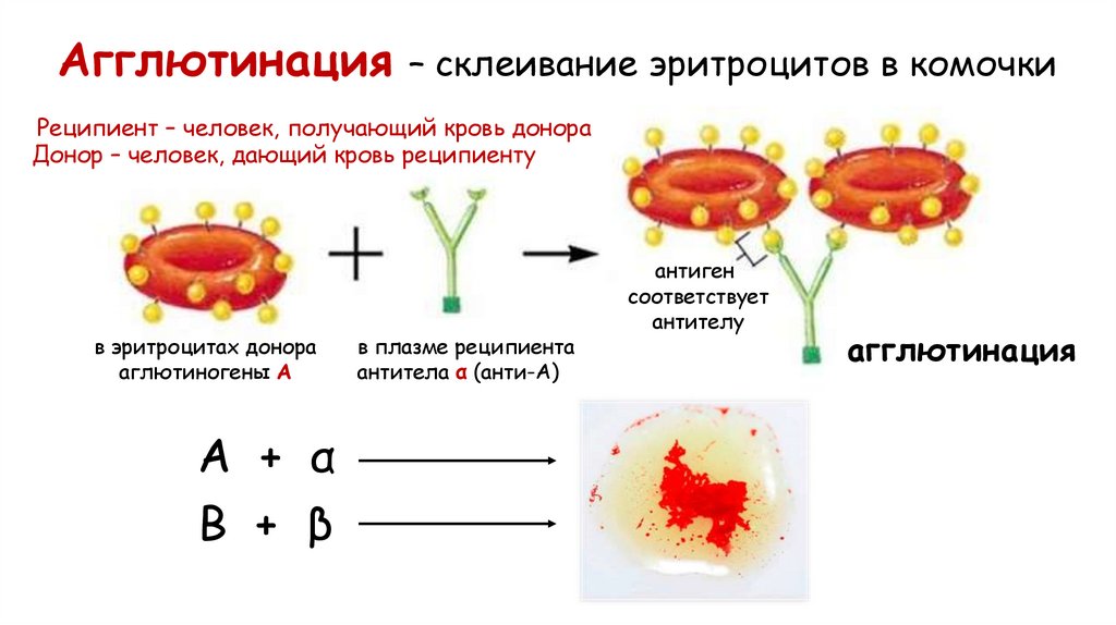 Агглютинация – склеивание эритроцитов в комочки