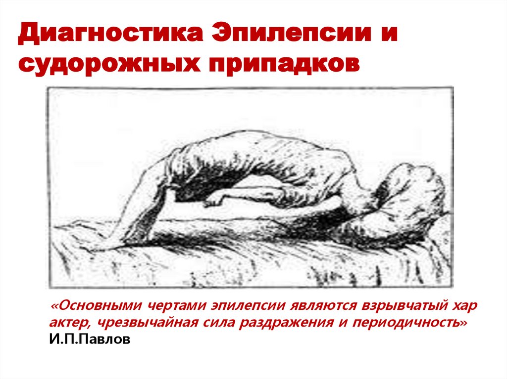 Диагностика Эпилепсии и судорожных припадков