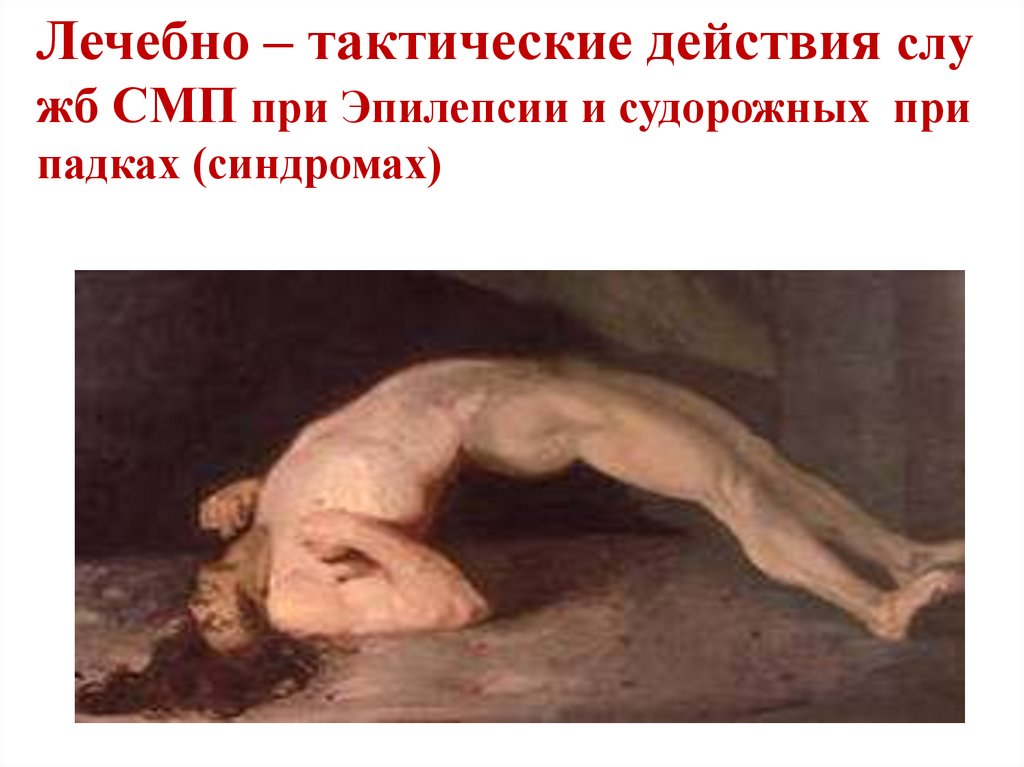 Лечебно – тактические действия служб СМП при Эпилепсии и судорожных припадках (синдромах)