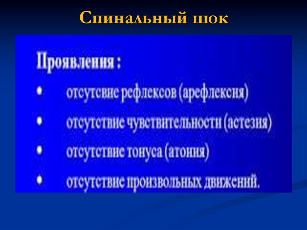 Спинальный шок